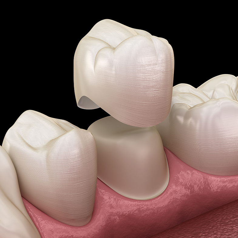Treatment - Dental Excellence