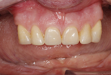 Before - Dental Excellence